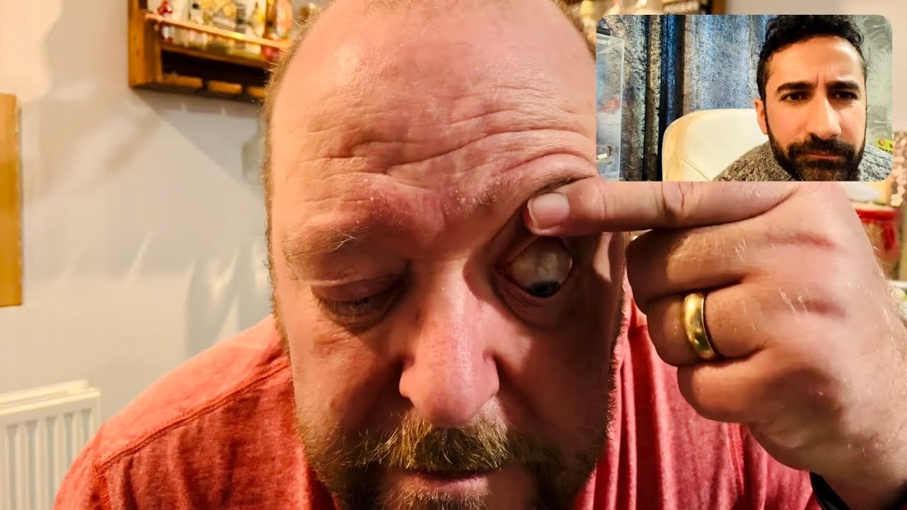 ASMR: Doctor Video Calls a Patient with Eye Issue (roleplay)