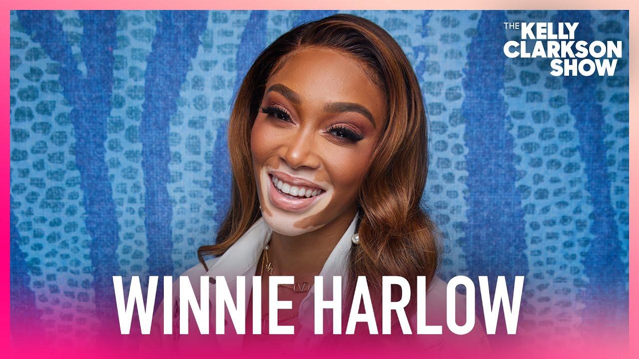 Winnie Harlow Shares How Bullying Pushed Her Towards Self-Love