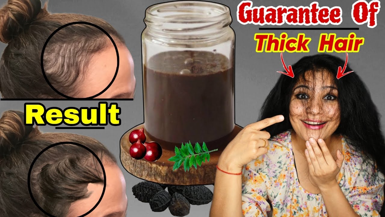This Is Guarantee Of Thick Hair & 100% Hair Regrowth:This Is Complete Hair Care To Regrow Lost Hair