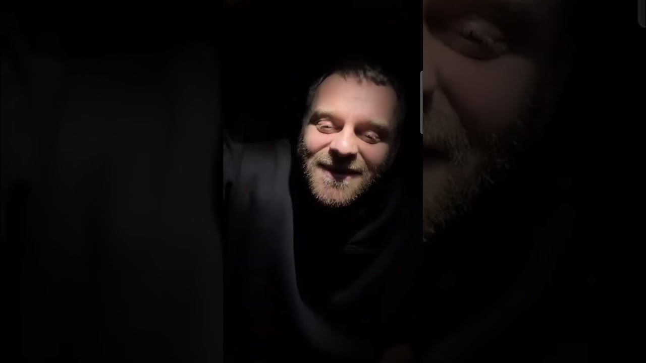 Увидел Шов у Мамы, 50 сантиметров, Я в Шоке, Медсестра Нашлась