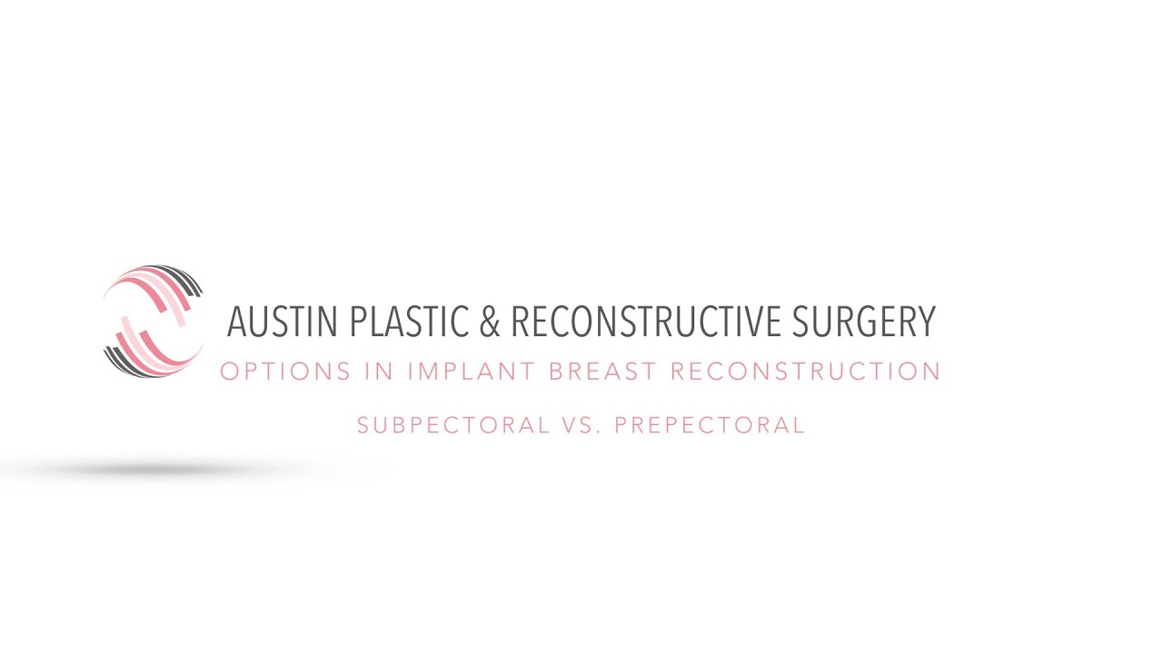 Options in Implant Breast Reconstruction: Subpectoral vs Prepectoral