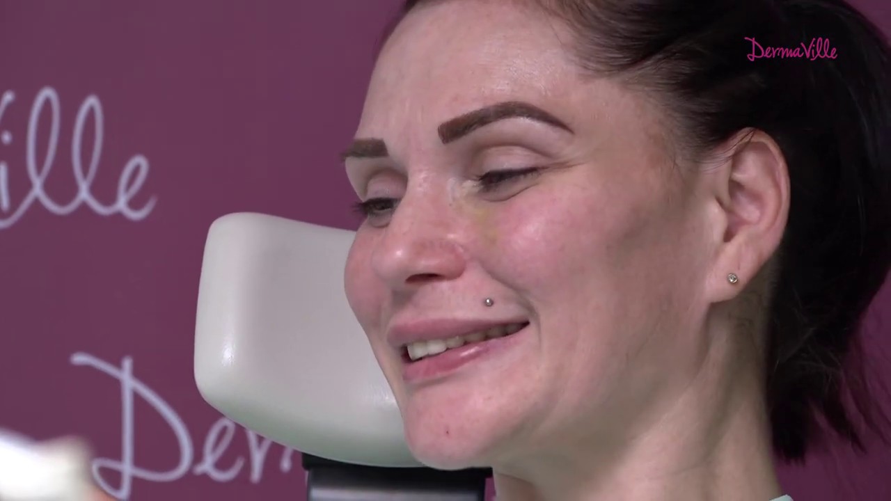 Kako se stomatološka ordinacija DermaVille pobrinula za Tijanin Hollywood smile - Trenutak iz sna S3