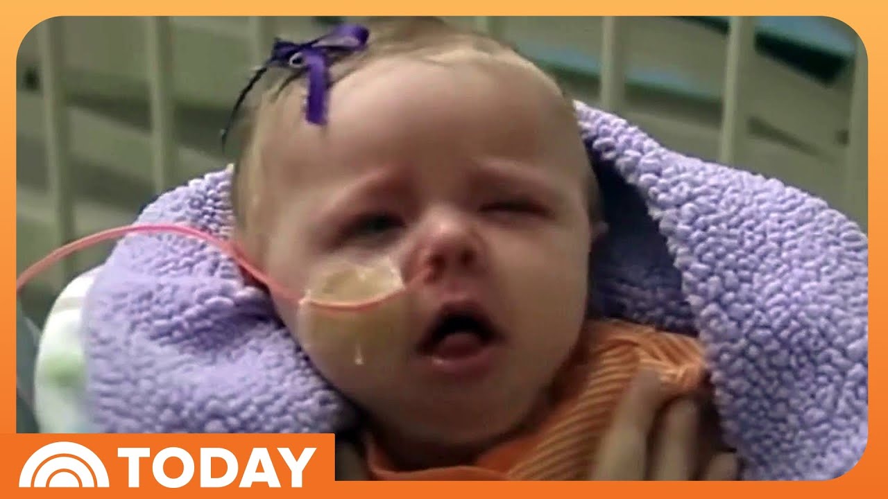 Whooping cough cases surge as vaccination rates continue to drop