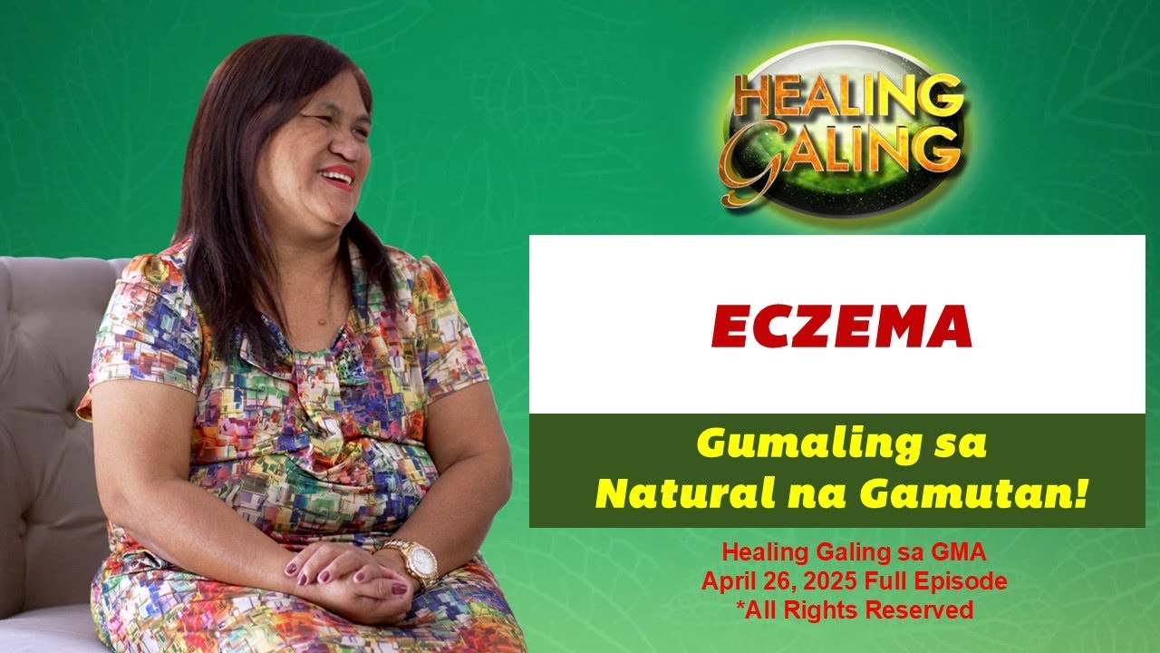Healing Galing sa GMA: Natural na Paggaling sa Eczema   Full Ep. (April 26, 2025 airing)