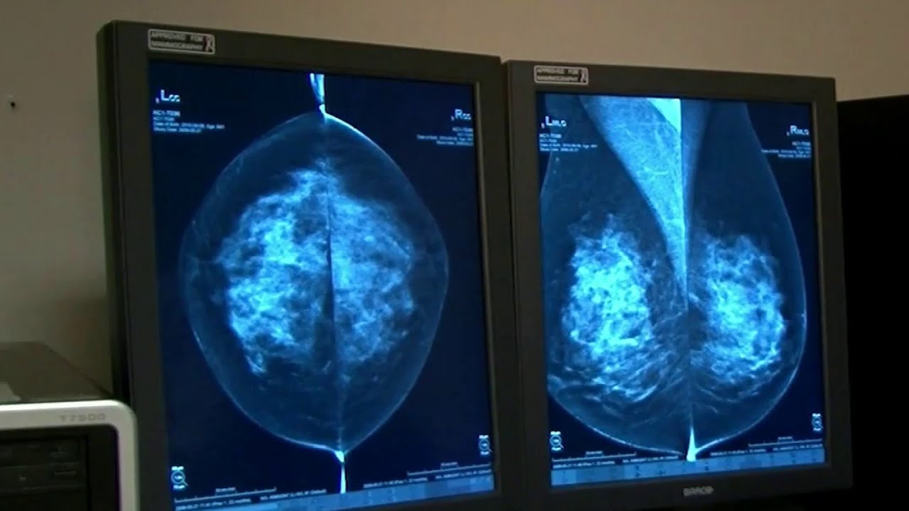 These are the health tests you should start getting at age 50
