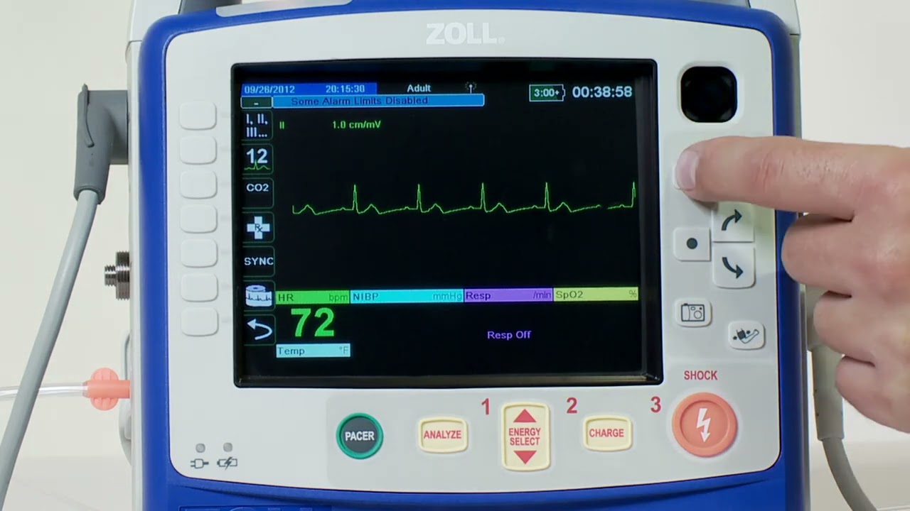 X Series®: Trending (English)