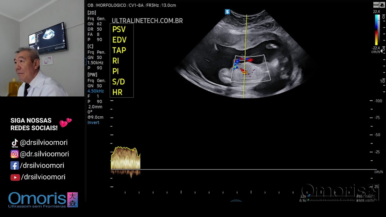 Ultrassom Gravidez 17 Semanas