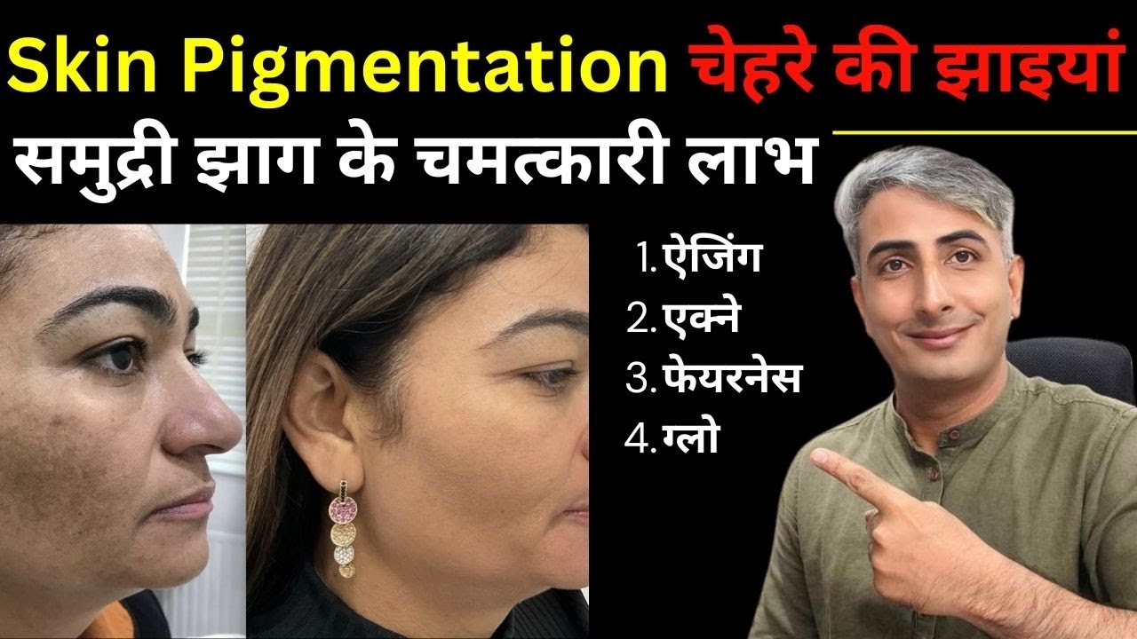 BENEFITS OF SMUDRI JHAAG I HOW TO REMOVE PIGMENTATION I DR. MANOJ DAS
