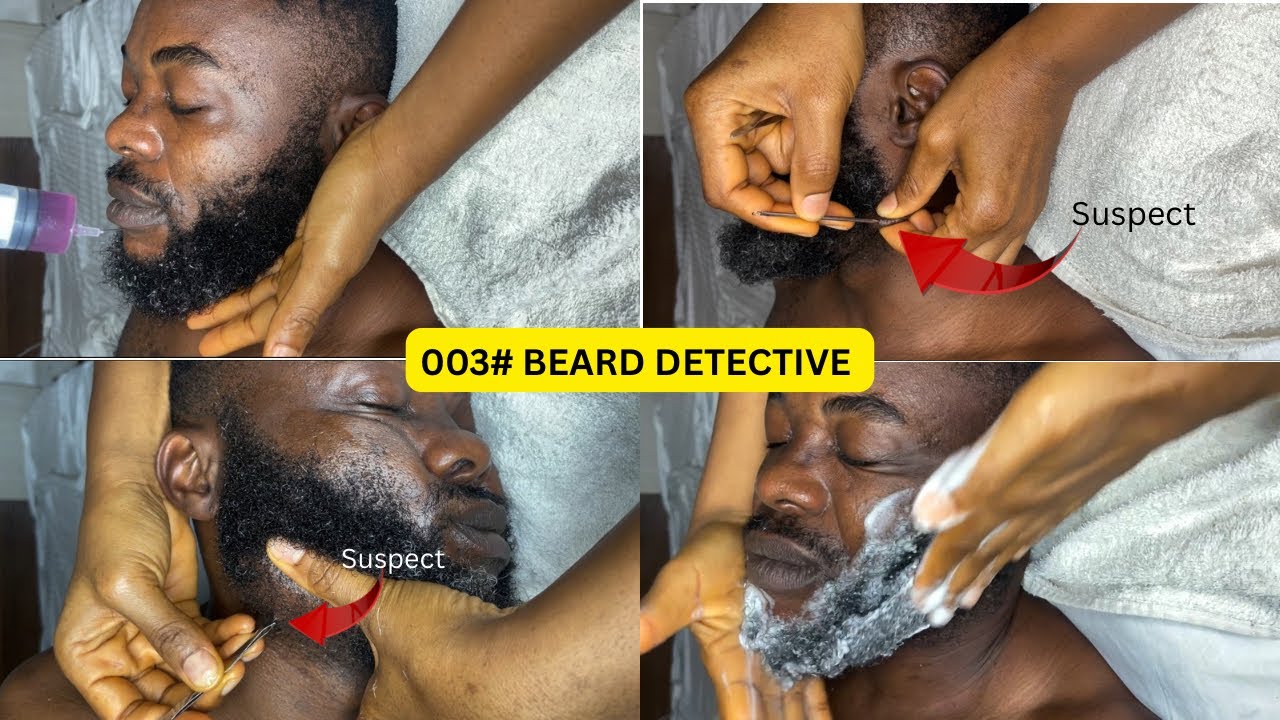 #003: BEARD DETECTIVE ASMR; Ingrown, Nitpicking, Grooming, Gray Hair/ Compound Hair Removal #asmr 