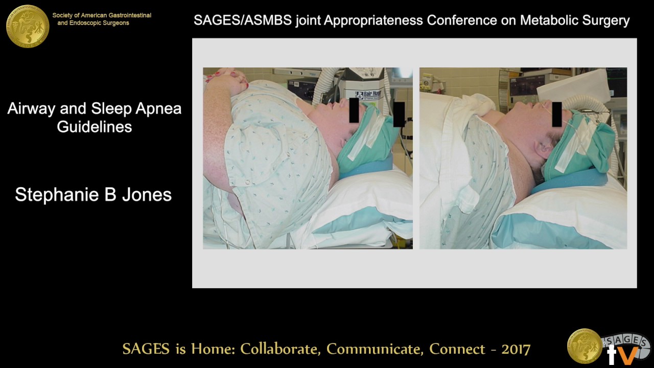 Guidelines for airway & sleep apnea management in the obese patient