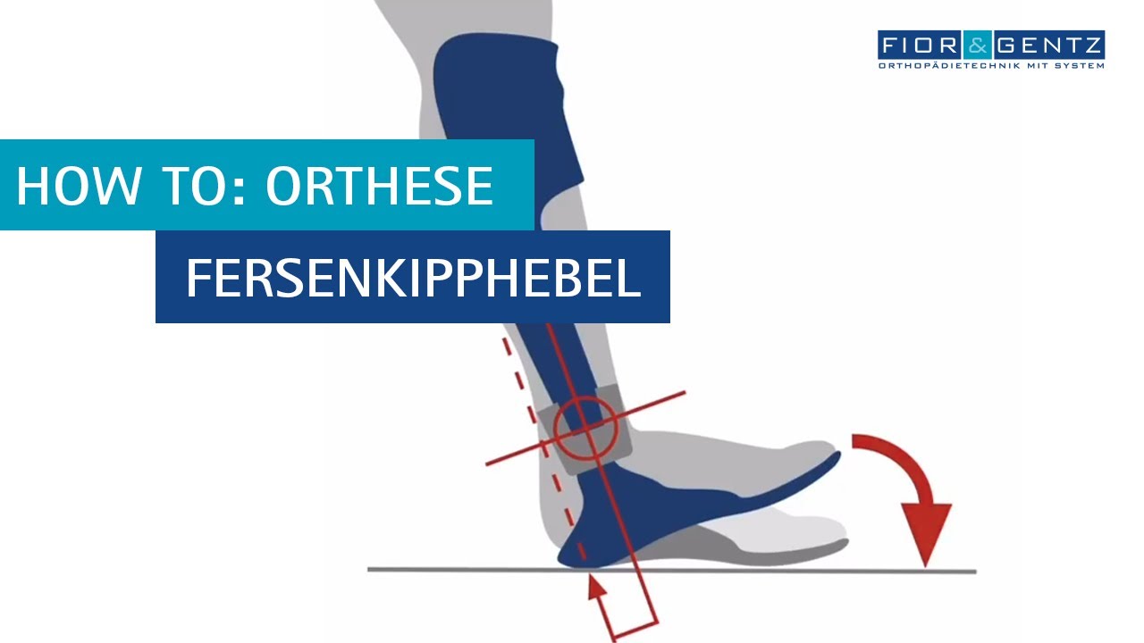 2. How to: Orthese – Fersenkipphebel/Plantaranschlag