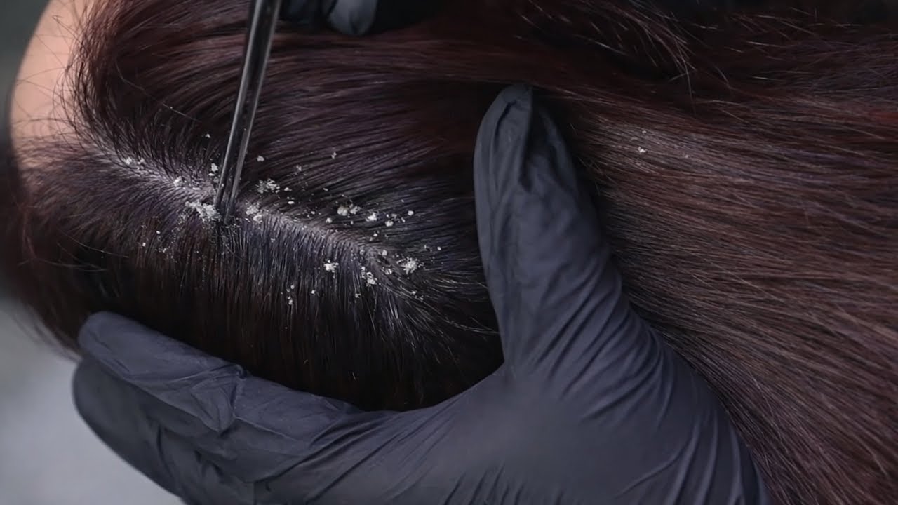 ASMR Detailed Scalp Treatment | Cleansing, Oiling & Deep Relaxation