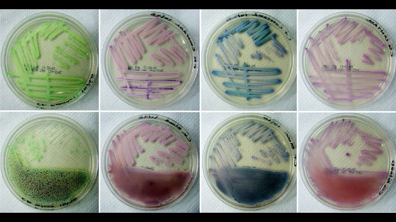 Contamination control: Back to basics