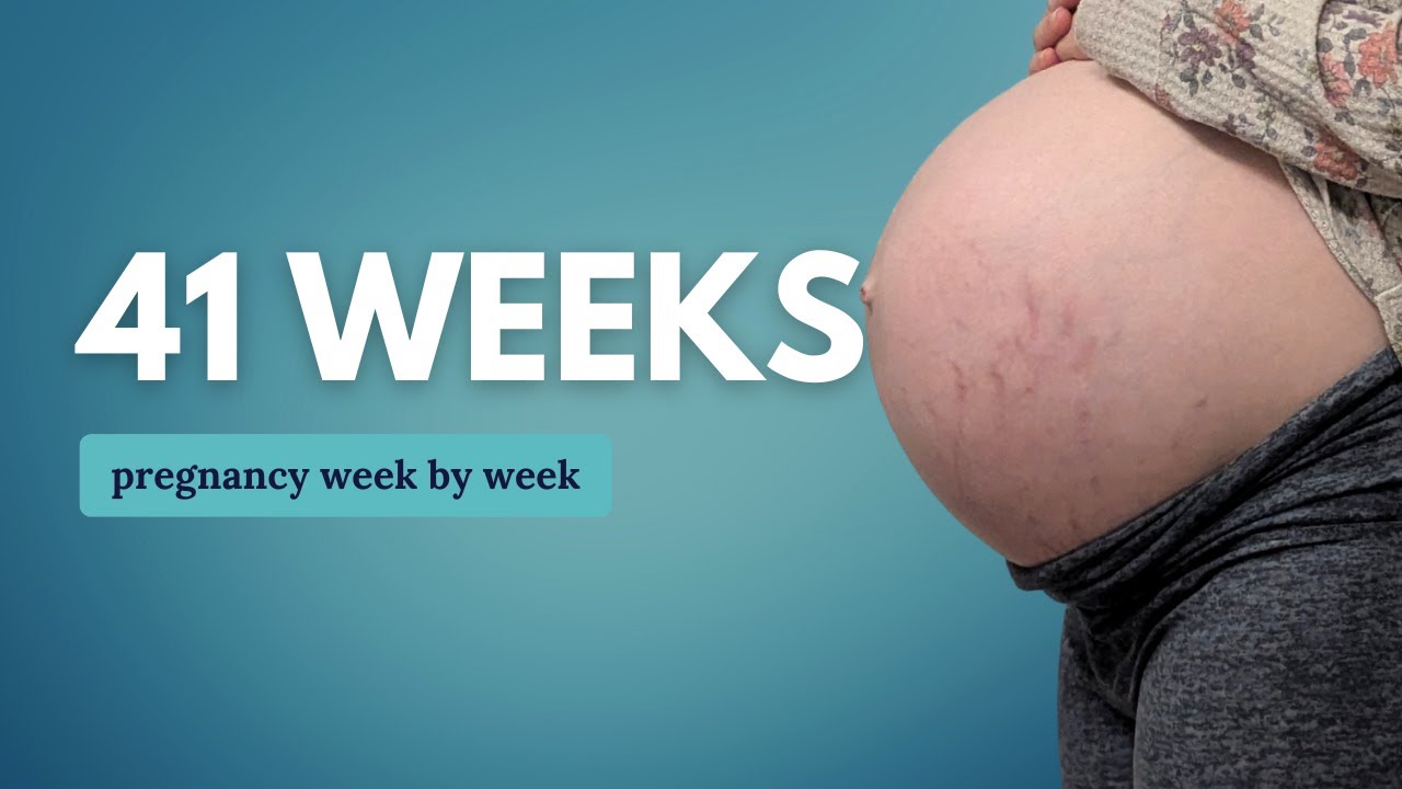 41 Weeks Pregnant 🤰 What to Expect When You Are Past Due