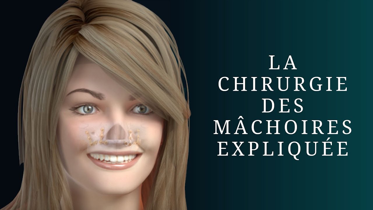 La chirurgie des mâchoires expliquée