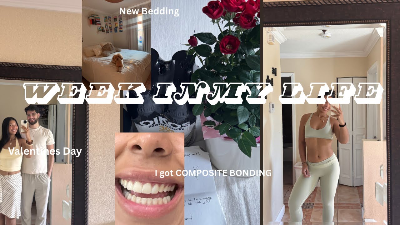 WEEK IN MY LIFE | Composite Bonding, Valentines Day, Workouts