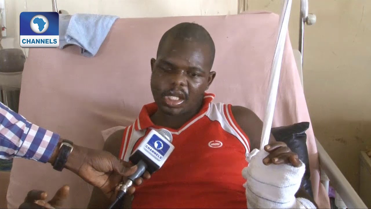 Benue Attack Survivor Narrates Ordeal