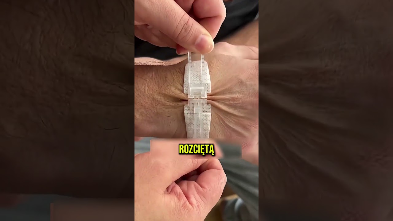 Koniec SZW&Oacute;W dzięki temu PLASTROWI! 😵