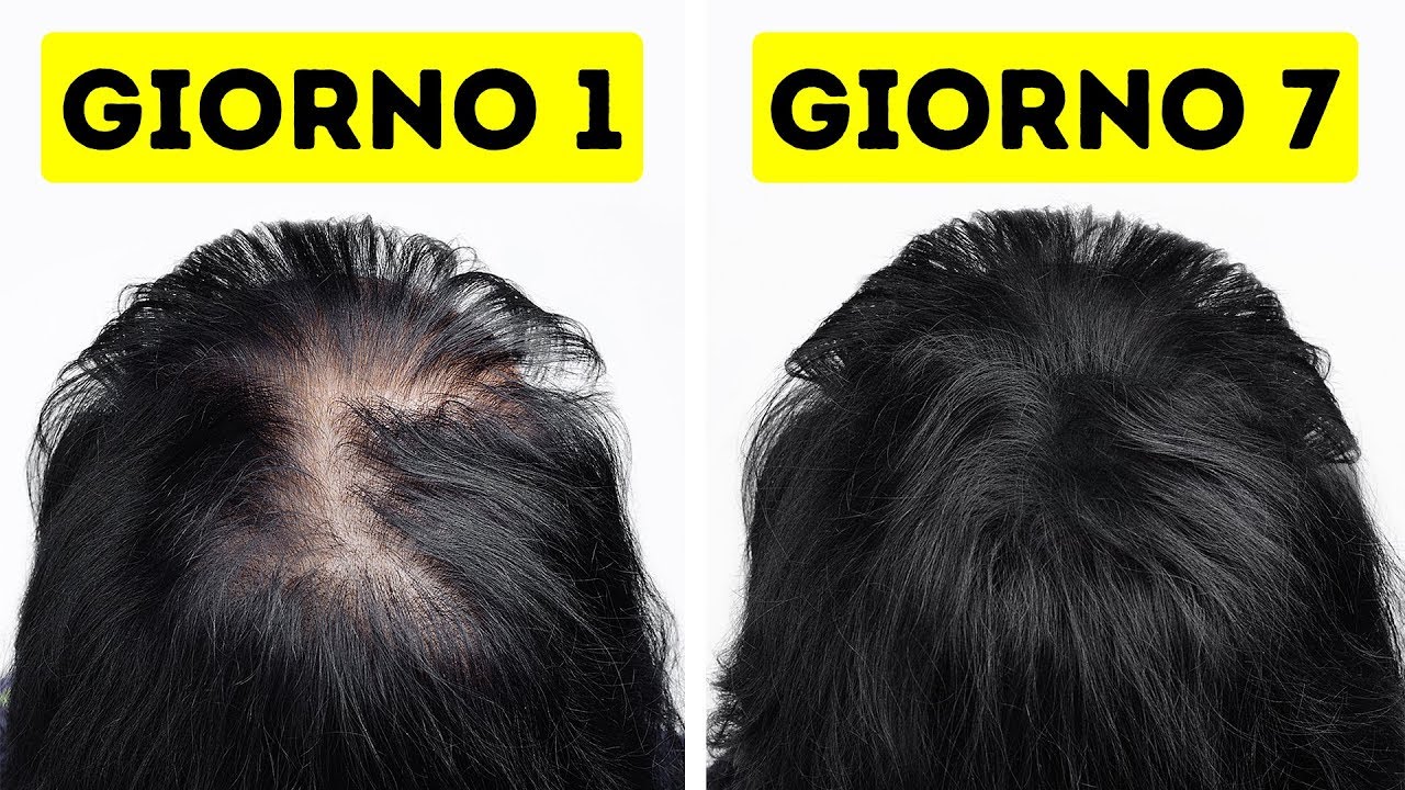 Ho Reso I Miei Capelli Più Sani E Forti In Appena Una Settimana