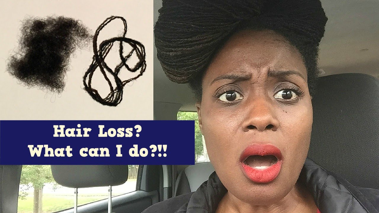 Hair Loss| Natural Hair   Locs and How to Address It