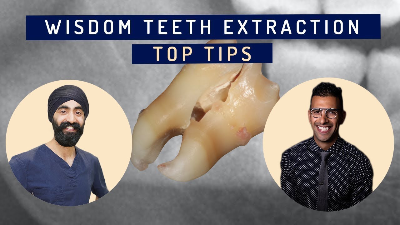 Wisdom Teeth Surgical Extraction Top Tips - PDP092