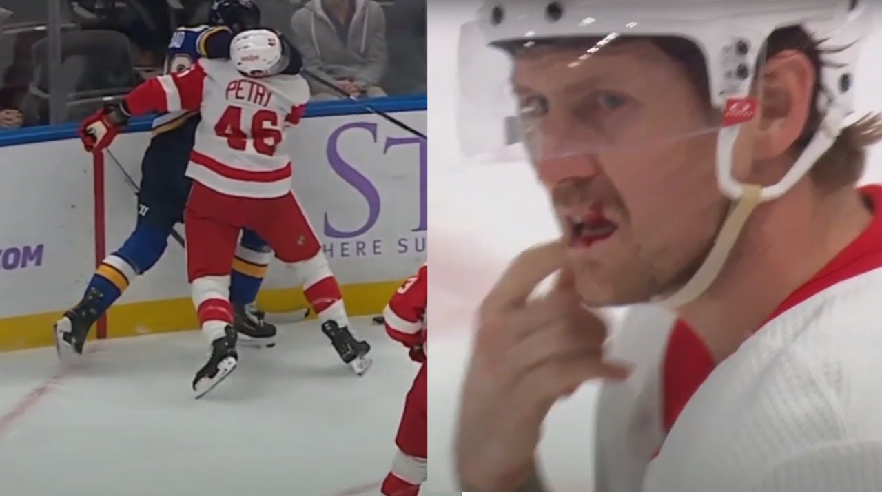 Jeff Petry Leaves Game With Blood After Elbow From Brandon Saad
