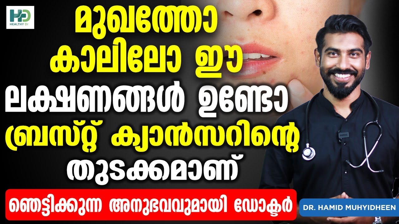 മുഖത്തോ കാലിലോ ഈ ലക്ഷണങ്ങൾ ഉണ്ടോ ബ്രസ്റ്റ് ക്യാൻസറിന്റെ തുടക്കമാണ് | Breast cancer symptoms