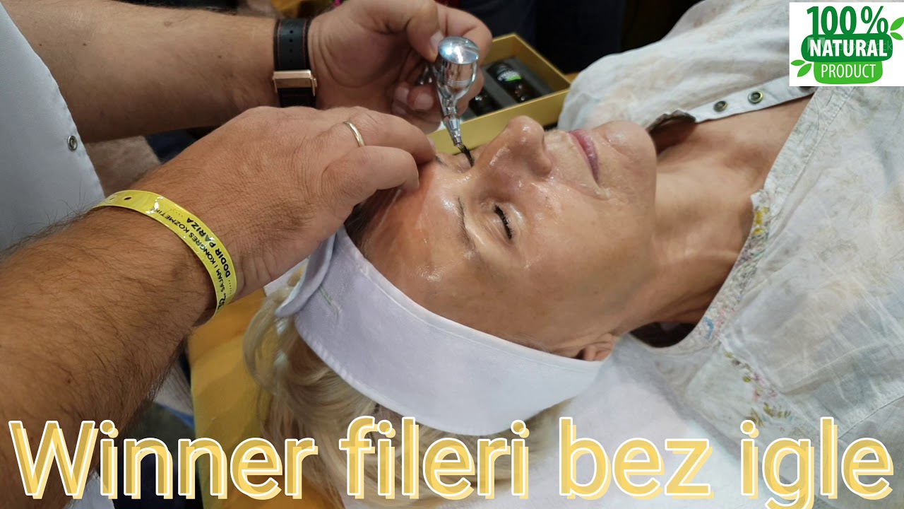 FILERI BEZ IGLE 100%NATURAL HYALURON