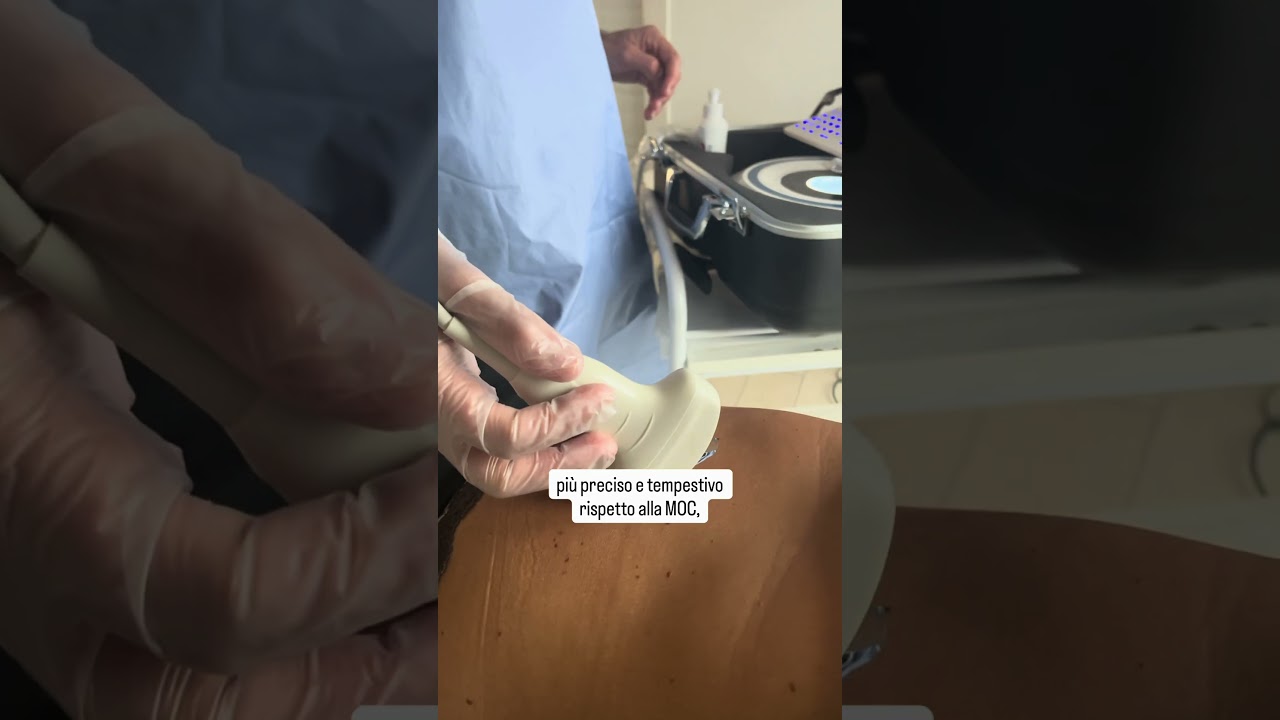 MOC Ecografica: l&rsquo;innovazione per la diagnosi dell&rsquo;Osteoporosi - In Salus Lecco
