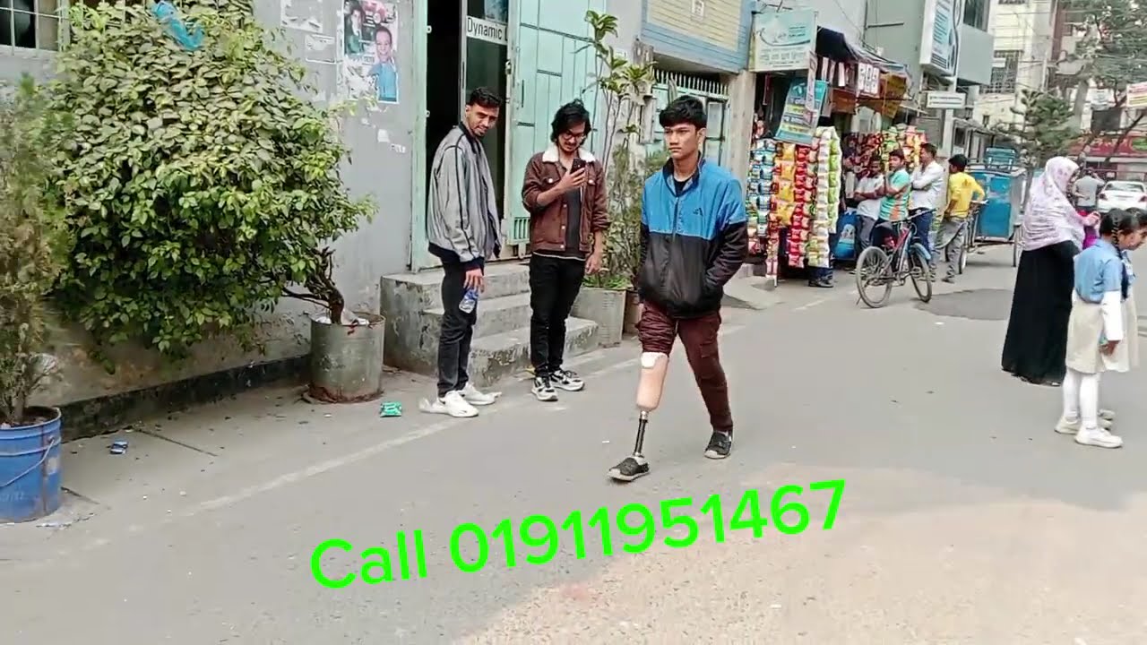 Artificial Leg Below Knee Prosthesis Dhaka Bangladesh হাঁটুর নিচে কৃত্রিম পা সংযোজন বাংলাদেশ