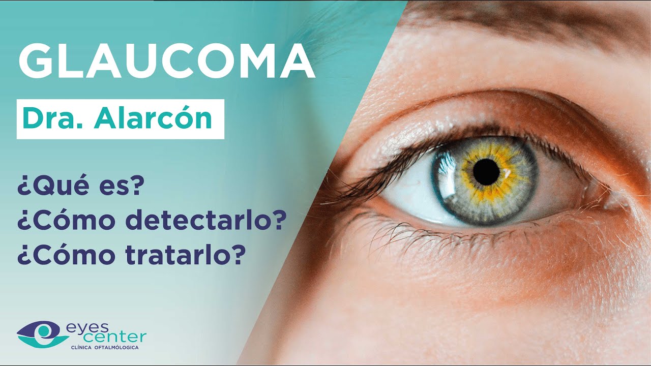 ¿Qué es el glaucoma y por qué es una señal de alarma? - Eyes Center