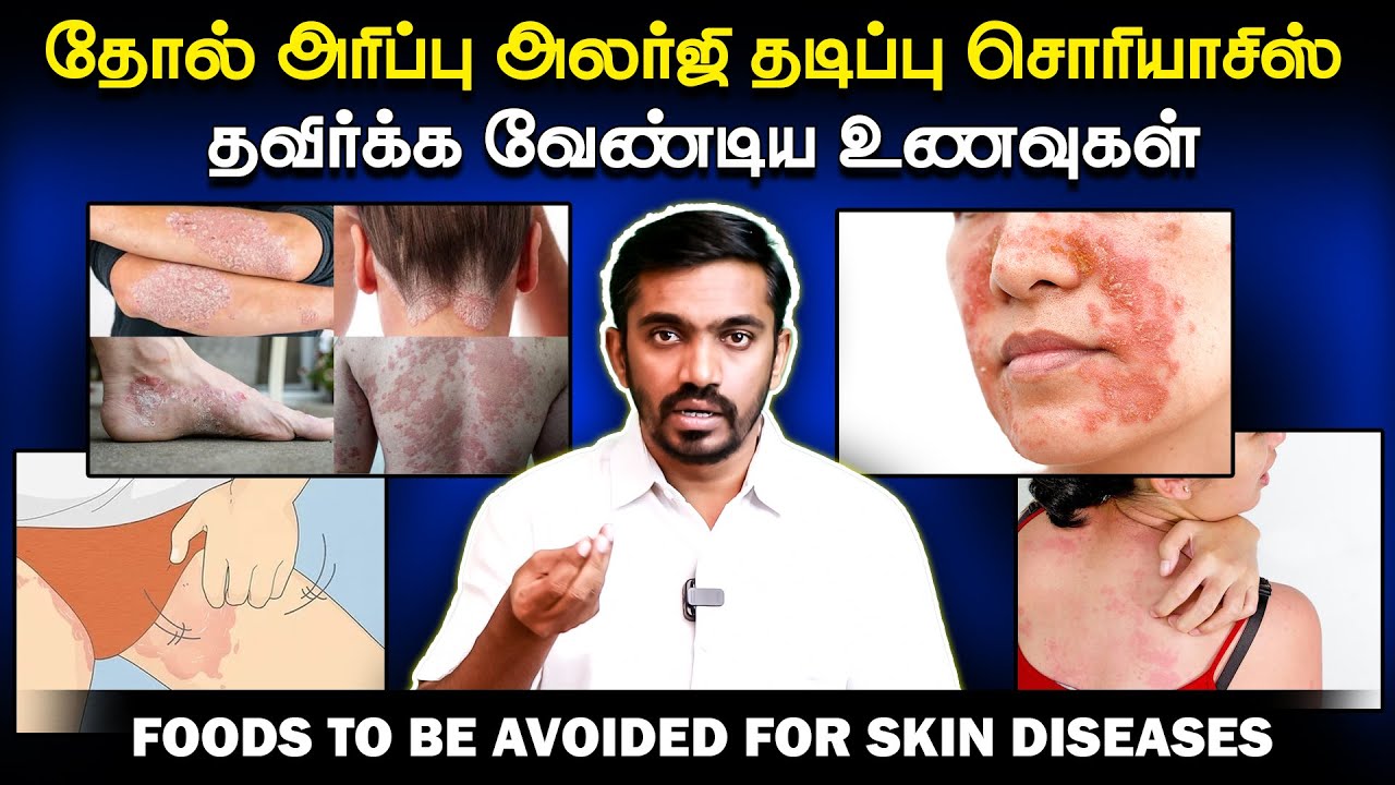 கண்டிப்பா சாப்பிட வேண்டாம் அரிப்பு தடிப்பு தோல் நோய்கள் இருந்தால் NEVER EAT FOR ECZEMA SKIN DISEASES