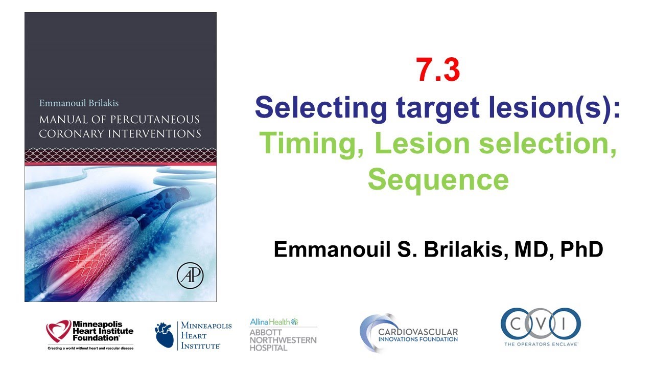 7.3 Manual of PCI - PCI timing, lesion selection, sequence