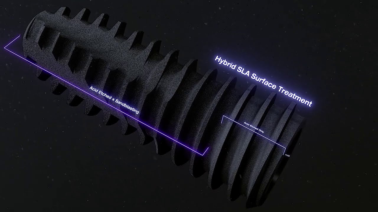 NEW Implante UF