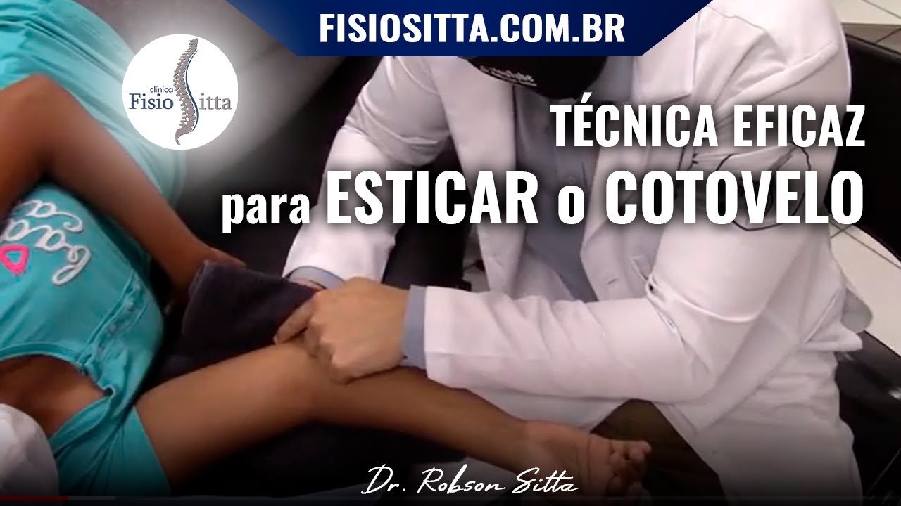 EXTENSÃO do COTOVELO PÓS FRATURA AMPLITUDE DE MOVIMENTO TÉCNICA PNF Fisioterapia Dr. Robson Sitta