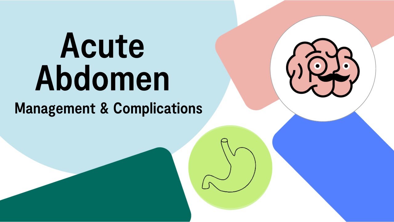UKMLA AKT Acute Abdomen: Diagnosis, Management and Complications | Multiple Choice Questions