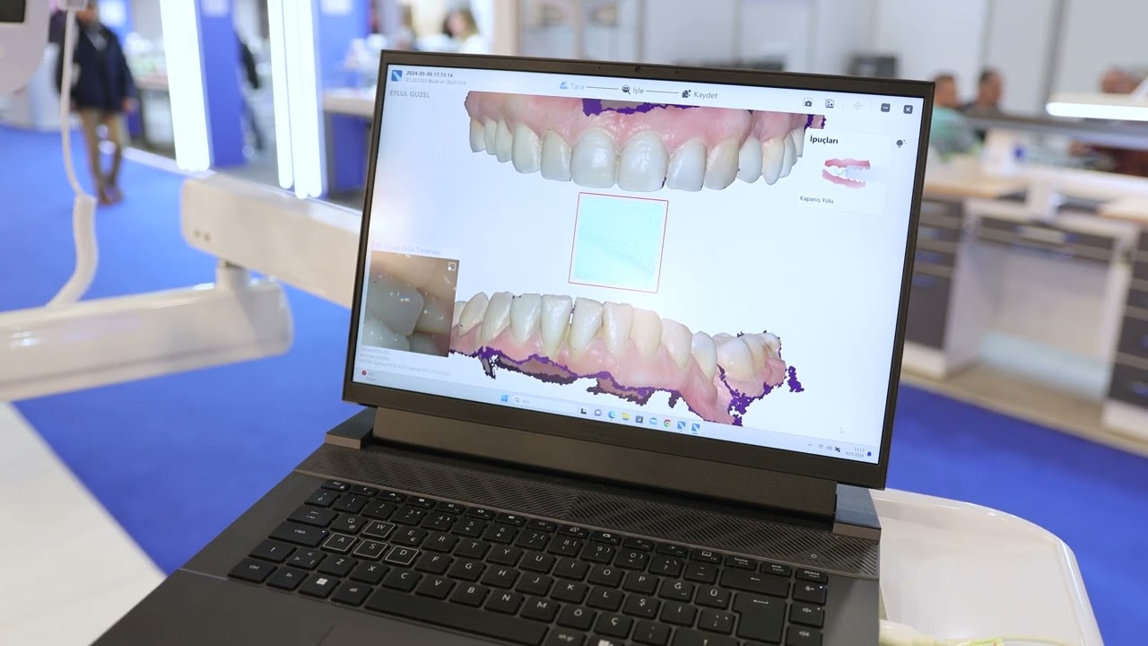 DTS AĞIZ İÇİ TARAYICI (Intra Oral Scanner) FUAR CANLI TARAMA