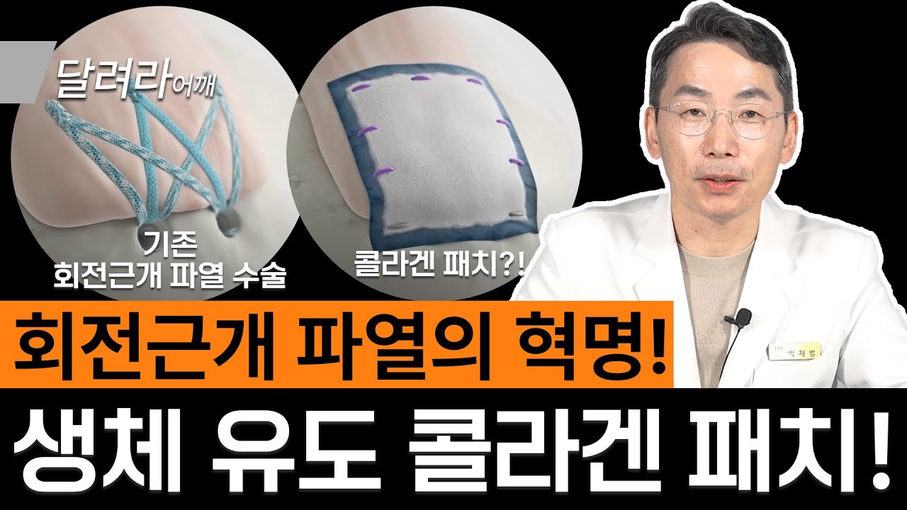 재파열을 줄여주는 혁신적인 어깨 회전근개 파열 치료법 | 리제네텐