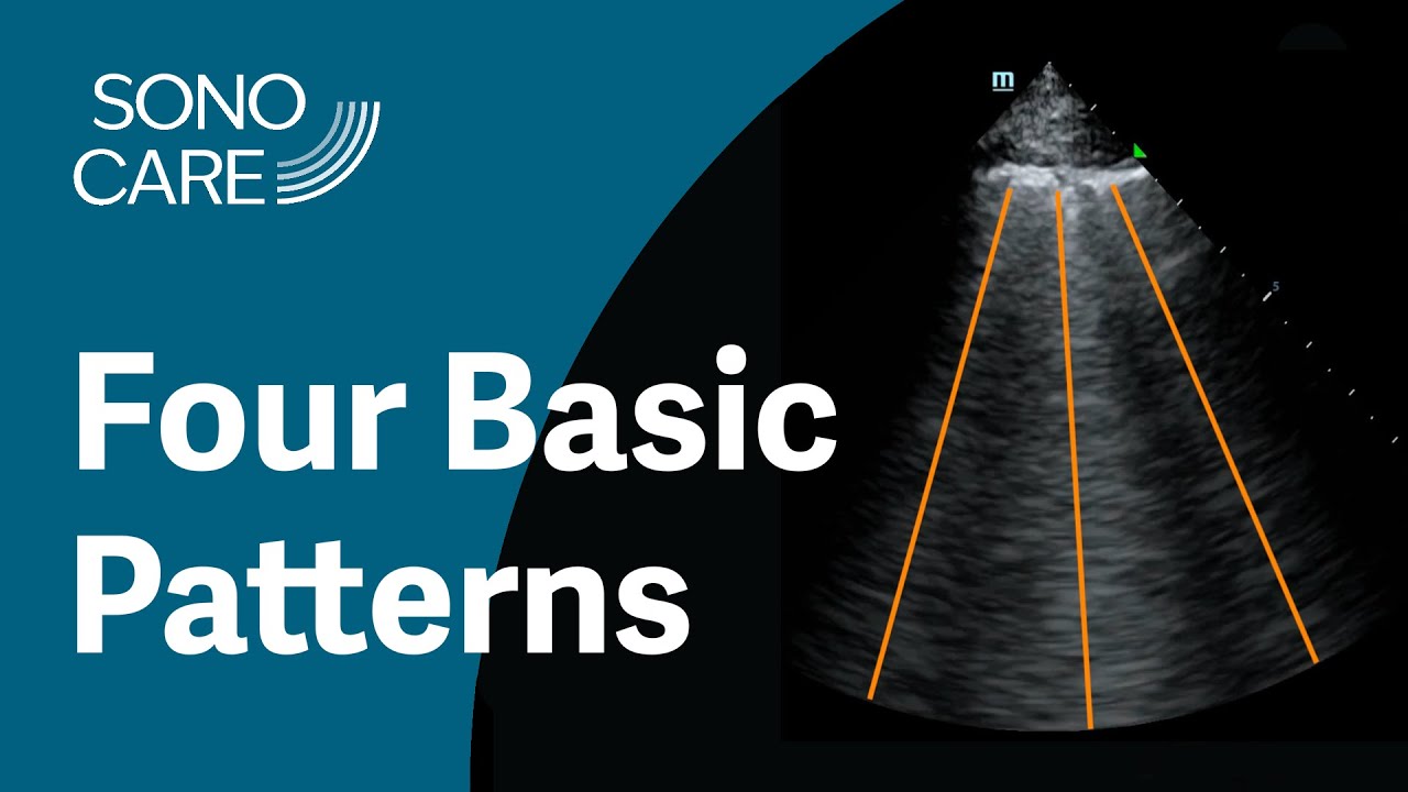 4 Basic Lung Patterns: Lung #2