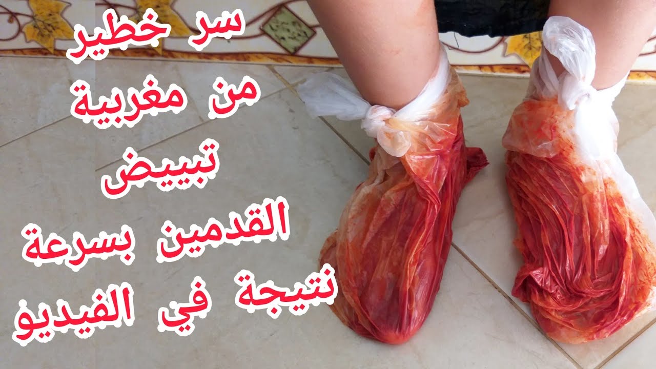 تهلاي في رجيلاتك في هاد صيف توريد وترطيب وتبييض وحتى لطراس سندالة غادي يحيد❤