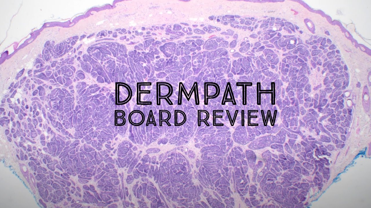 Dermatology & Pathology Board Review: Hyaluronic Acid Filler, Trichoblastoma, Blue Nevus & more.