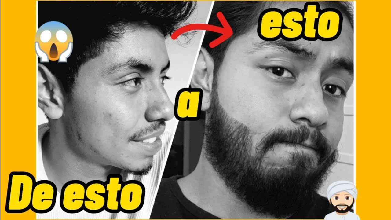 Usé MINOXIDIL para la BARBA y esto PASÓ