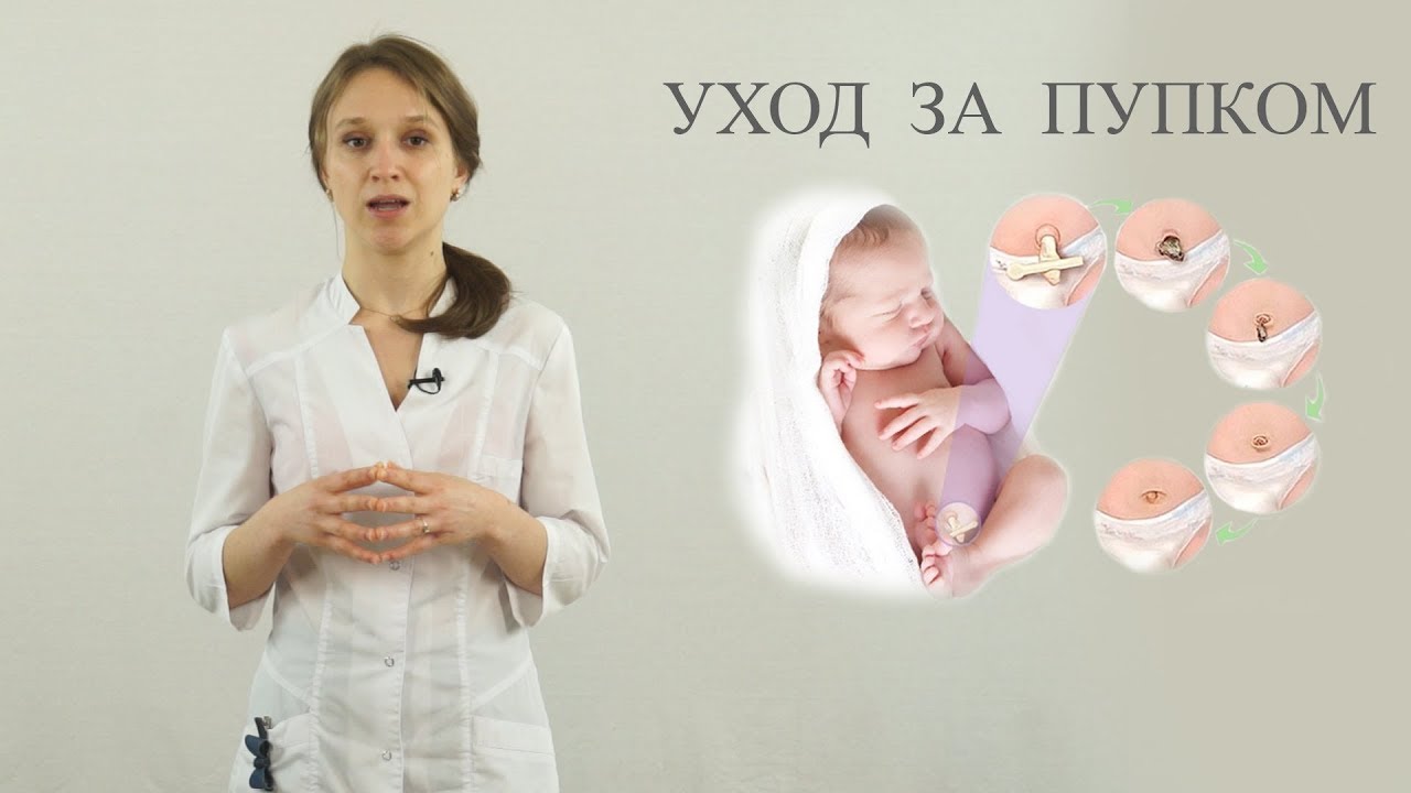 Уход за пупком новорожденного