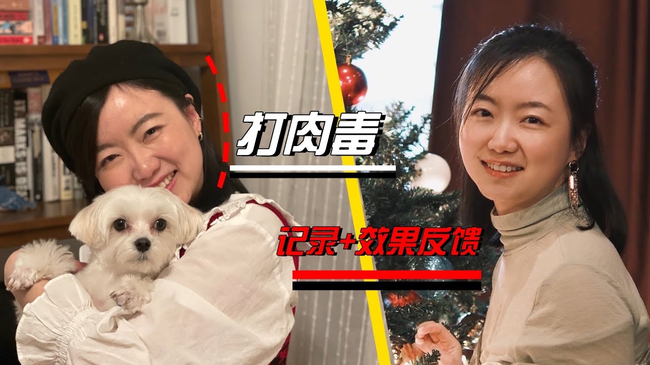 去打除皱针啦｜打肉毒全程记录+效果反馈｜迈出与年龄抗争的第一步