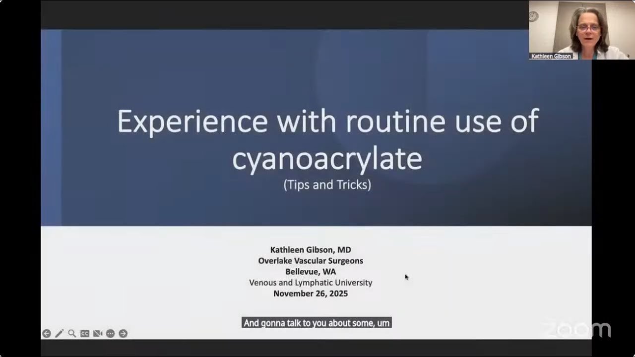 VEIN UNIVERSITY GRAND ROUNDS: Experience With Routine Use of Cyanoacrylate: Tips and Tricks