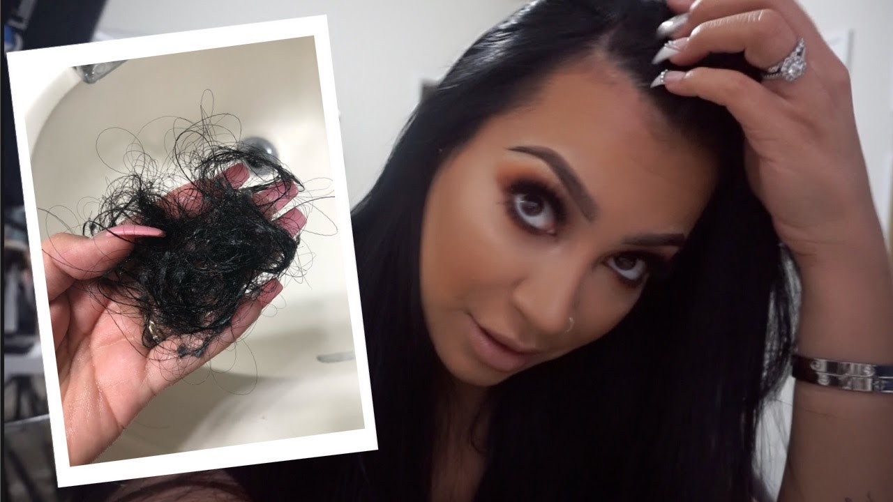 I'M LOSING MY HAIR! || POSTPARTUM HAIR LOSS