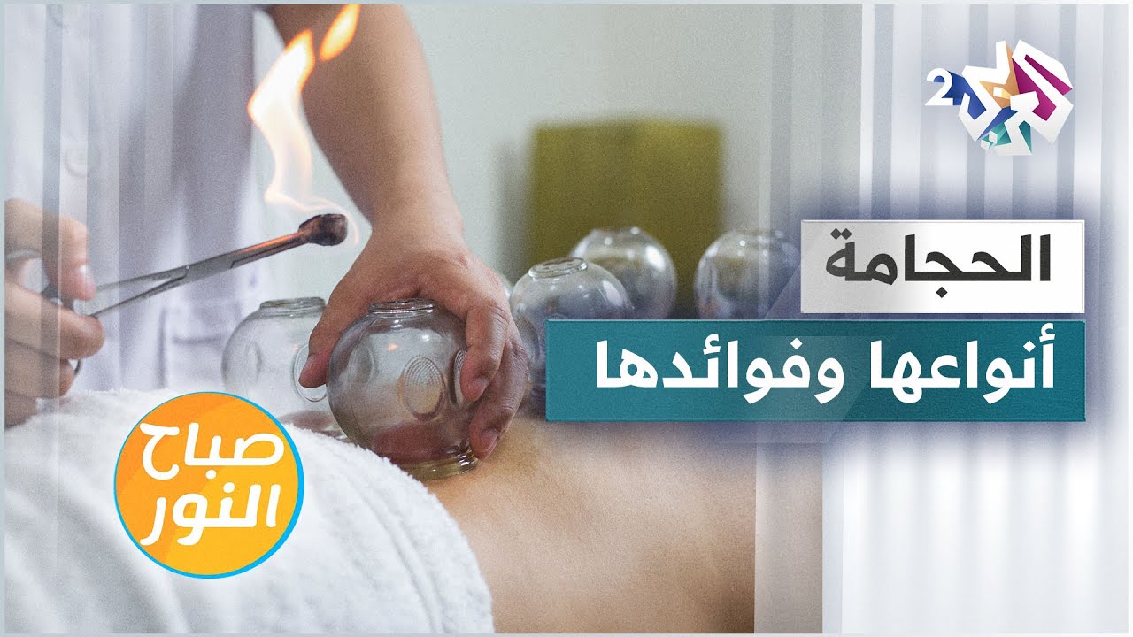 الحجامة .. أنواعها وفوائدها للجسم