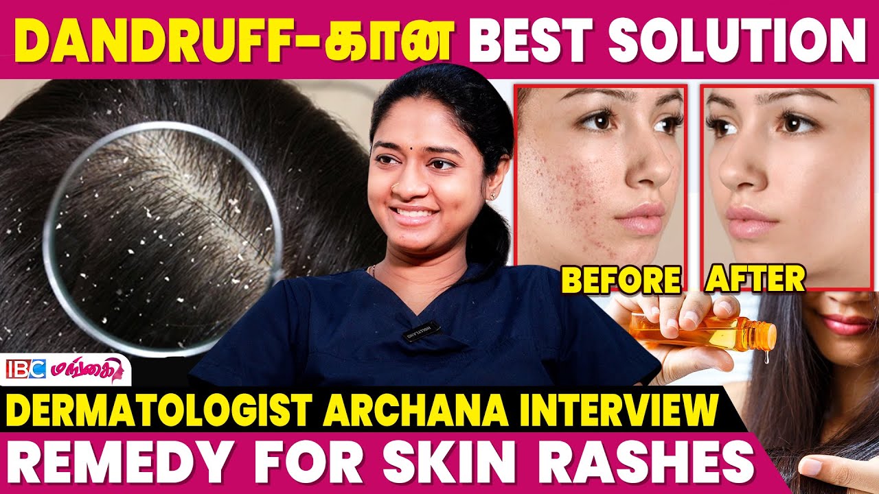 Solution for Skin and Hair Problems - Dermatologist Archana Interview | Dandruff | Vitiligo