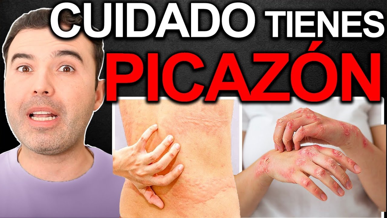 Porqué Me Pica La Piel? - Causas Y Soluciones Para Eliminar La Picazón
