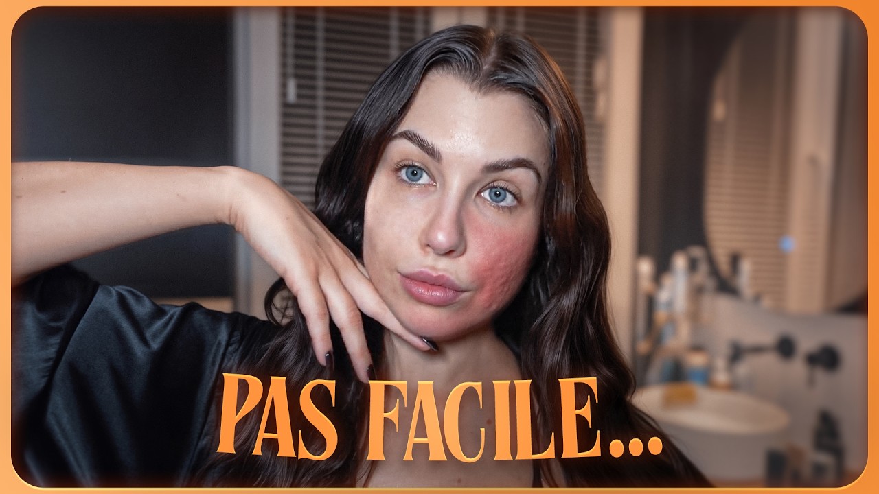 update de ma peau : conséquences de roaccutane, rosacée...